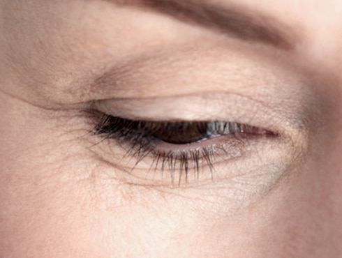 मोठ्या प्रमाणात डोळे चोळल्यानंतरथकवा आल्यानंतर किंवा रोजच्या सवयीमुळे तुम्ही दिवसभरातून कित्येकदा जर डोळे चोळत असाल तर यामुळे सुद्धा तुमच्या चेहऱ्यावर सुरकुत्या येऊ शकतात. डोळे अधिक प्रमाणात चोळल्यामुळे डोळ्याच्या आसपासचे प्रथिन घटक नष्ट होऊन सुरकुत्या पडतात.