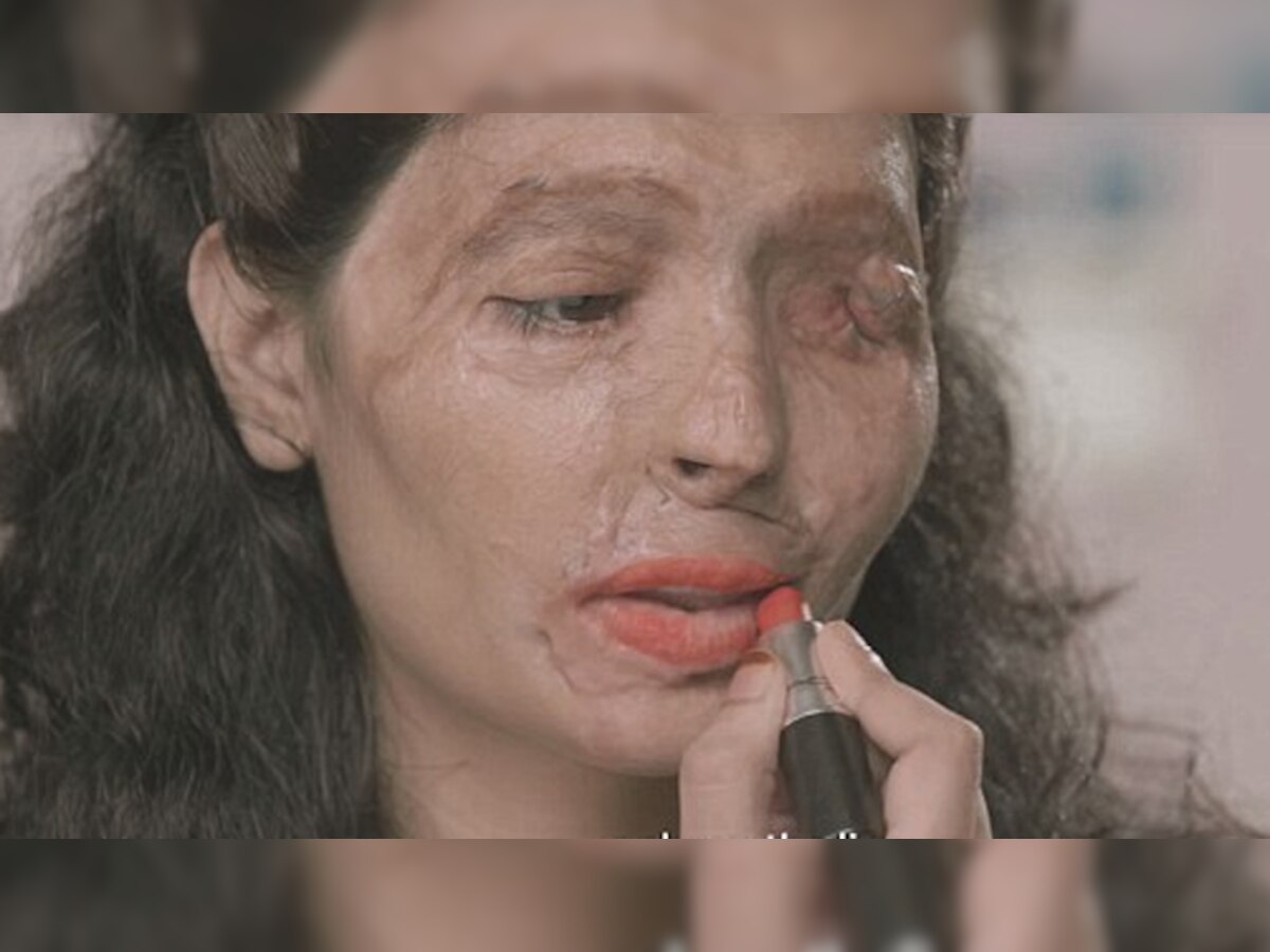 अनन्य व्यक्तीमत्व : मुंबईची रेश्मा बनली 'अॅन्ड अॅसिड सेल'चा चेहरा! title=