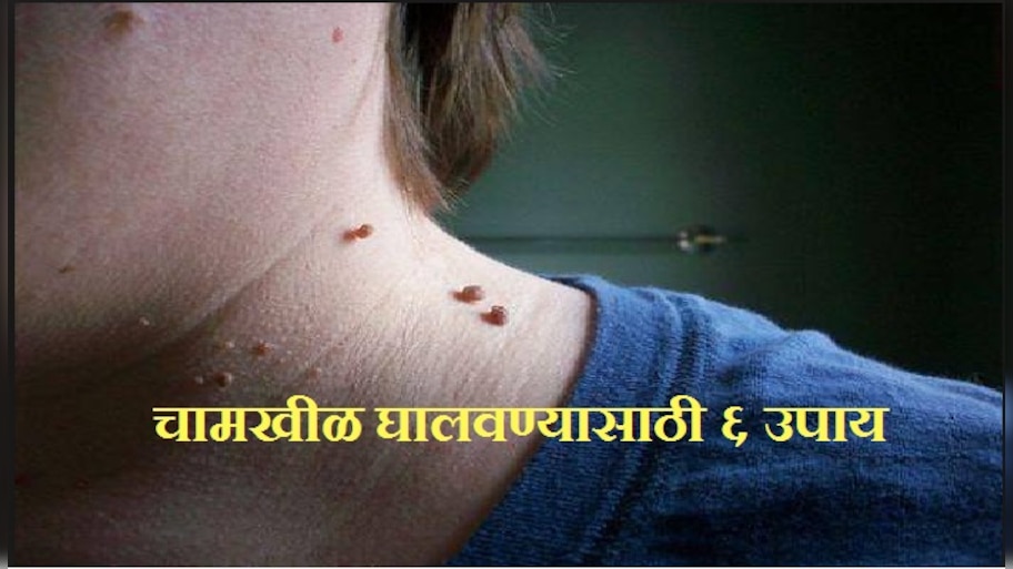 चामखीळ घालवण्यासाठी ६ घरगुती उपाय | हेल्थ News in Marathi