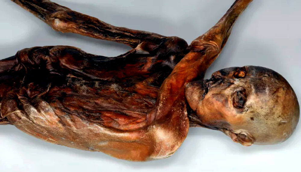 Otzi the Iceman