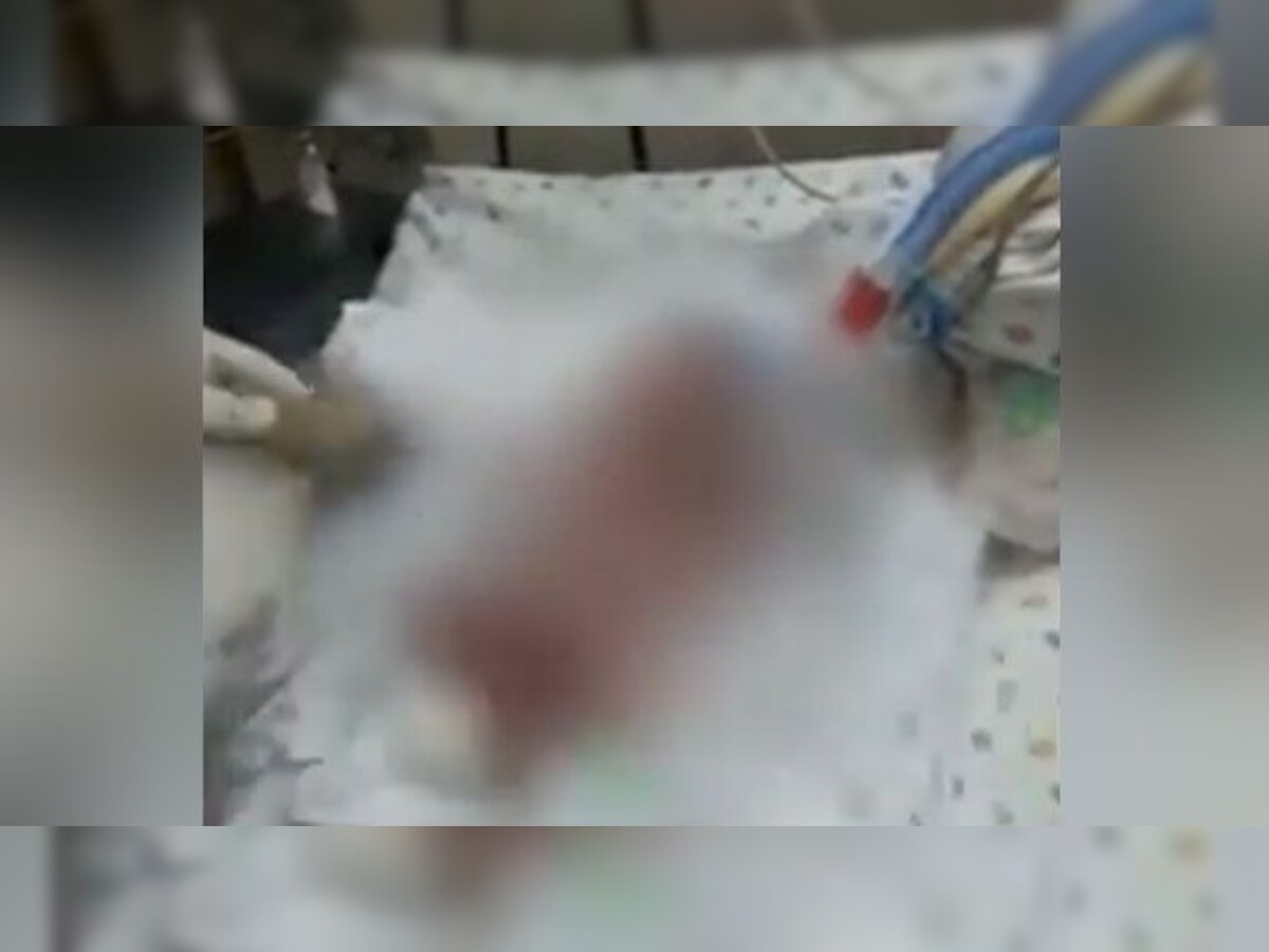 रुग्णालयानं चुकून मृत घोषित केलेल्या 'त्या' बाळाचा मृत्यू title=