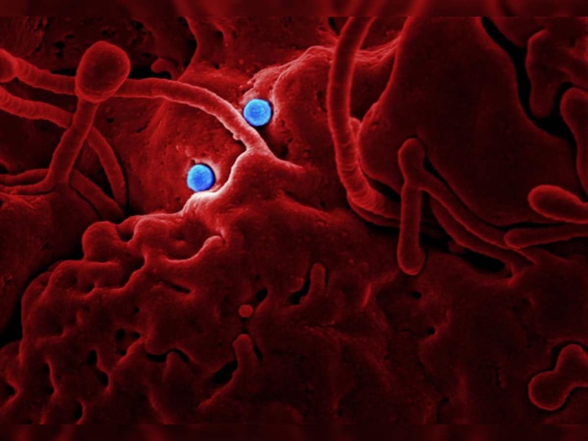 कोरोना व्हायरस : रोगापेक्षा उपचारच जीवावर बेतला; २७ लोकांचा मृत्यू  title=