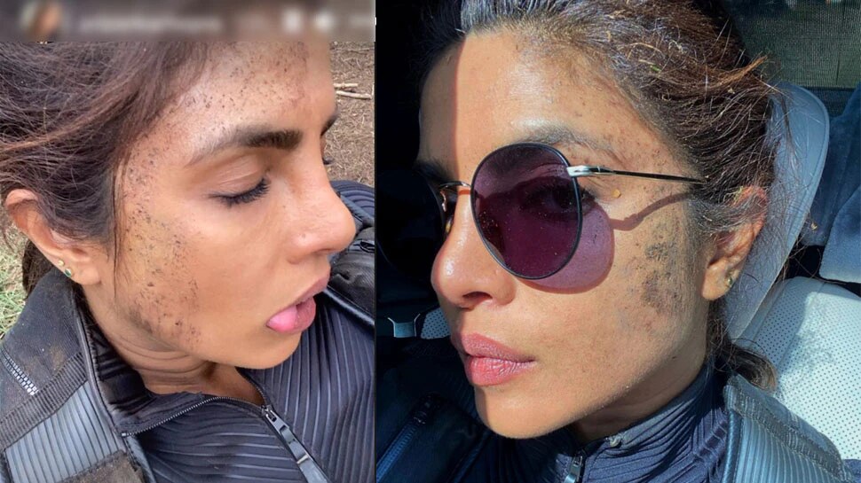 Bollywood Priyanka-chopra-injured-photos Viral