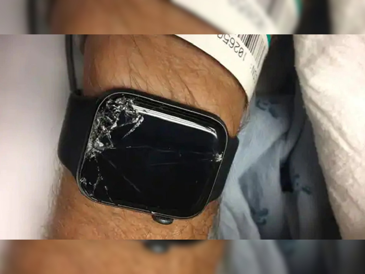 स्मार्ट उपकरणे माणसासाठी वरदान... Apple Watch ने असं आणलं मरणाच्या दारातून परत title=