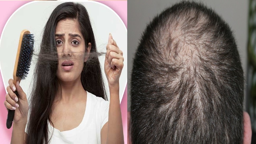 hair care tips in marathi Stop Hair Fall कसगळतचय समसयमळ तरसत  आहत क कसच वढ न हणयमग अस शकतत ह ७ करण  hair care routine  these are the common reasons for