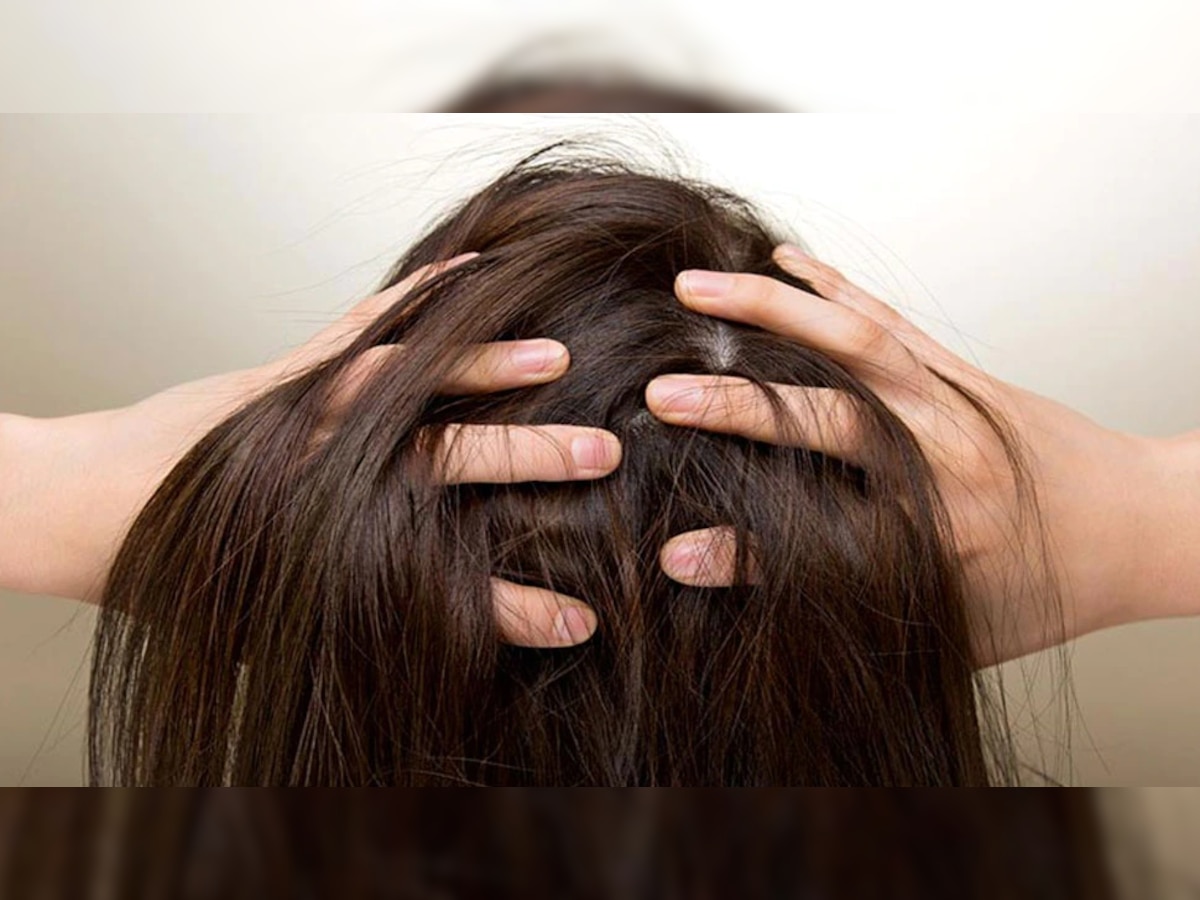 Hair Roots Pain : तुमच्याही केसांची मुळं दुखतायत? नक्का करा हे उपाय, आराम मिळालाच म्हणून समजा  title=