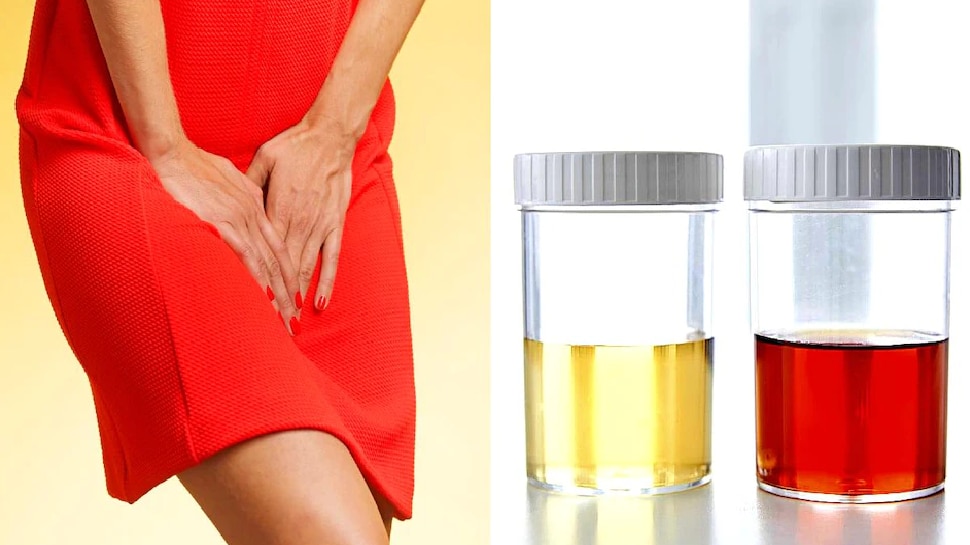 Blood in Urine may cause of dangerous health problem