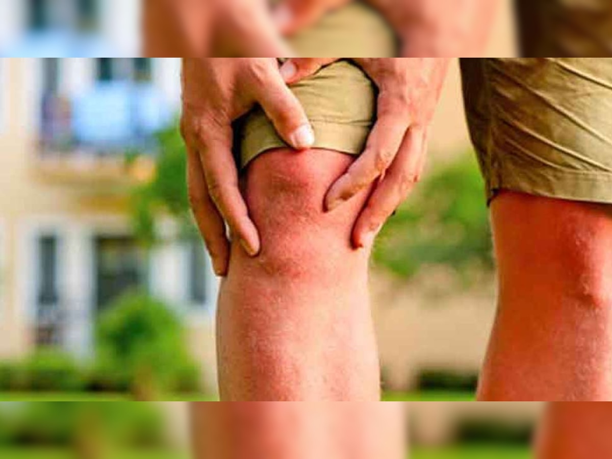 Knee Pain : गुडघेदुखीचा त्रास आहे, हे 5 पदार्थ खाल्ल्याने मिळेल आराम title=