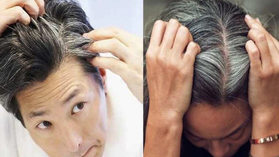 Premature greying white hair treatment clinic in delhi India