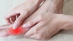 Uric Acid पासून मुक्ती मिळवा, आजच वापरा 'हा' मसाला