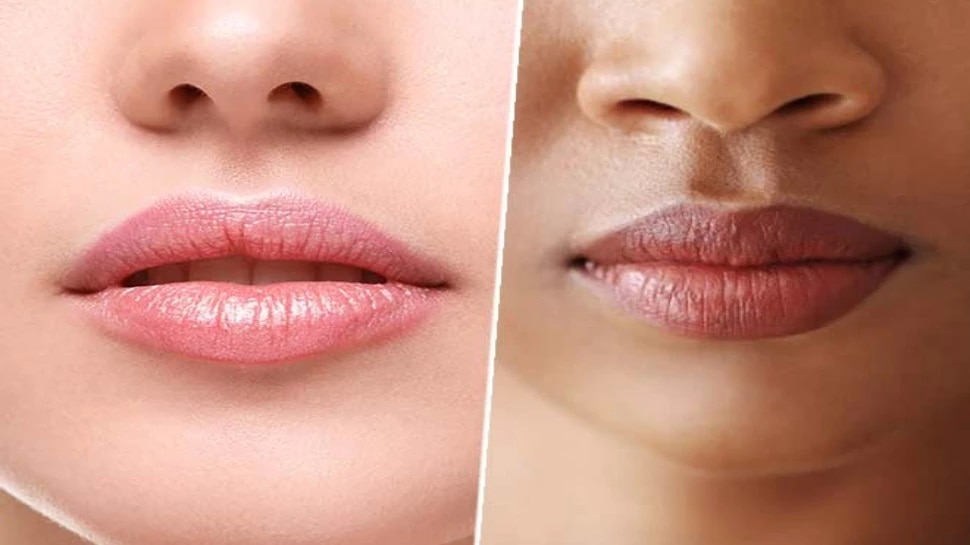 dark lips treatment home remedies to get rid of dark lips News in Marathi