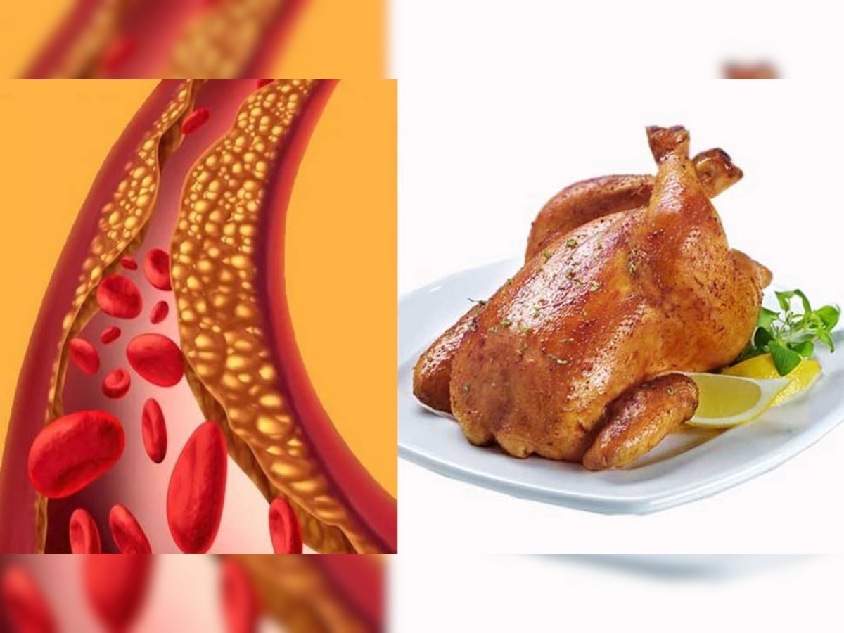 Cholesterol In Chicken: चिकन खाल्ल्याने कोलेस्ट्रॉल वाढतं का? जाणून घ्या आरोग्यदायी उपाय title=