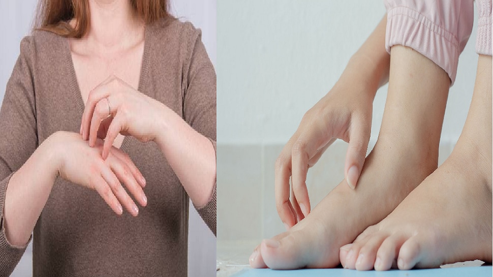 fatty-liver-symptoms-hands-and-leg-itching-more-signs-skin-changes