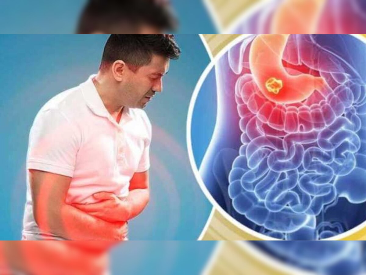 Gastric Problem Solutions: पोटाच्या समस्यावर घरगुती उपाय title=