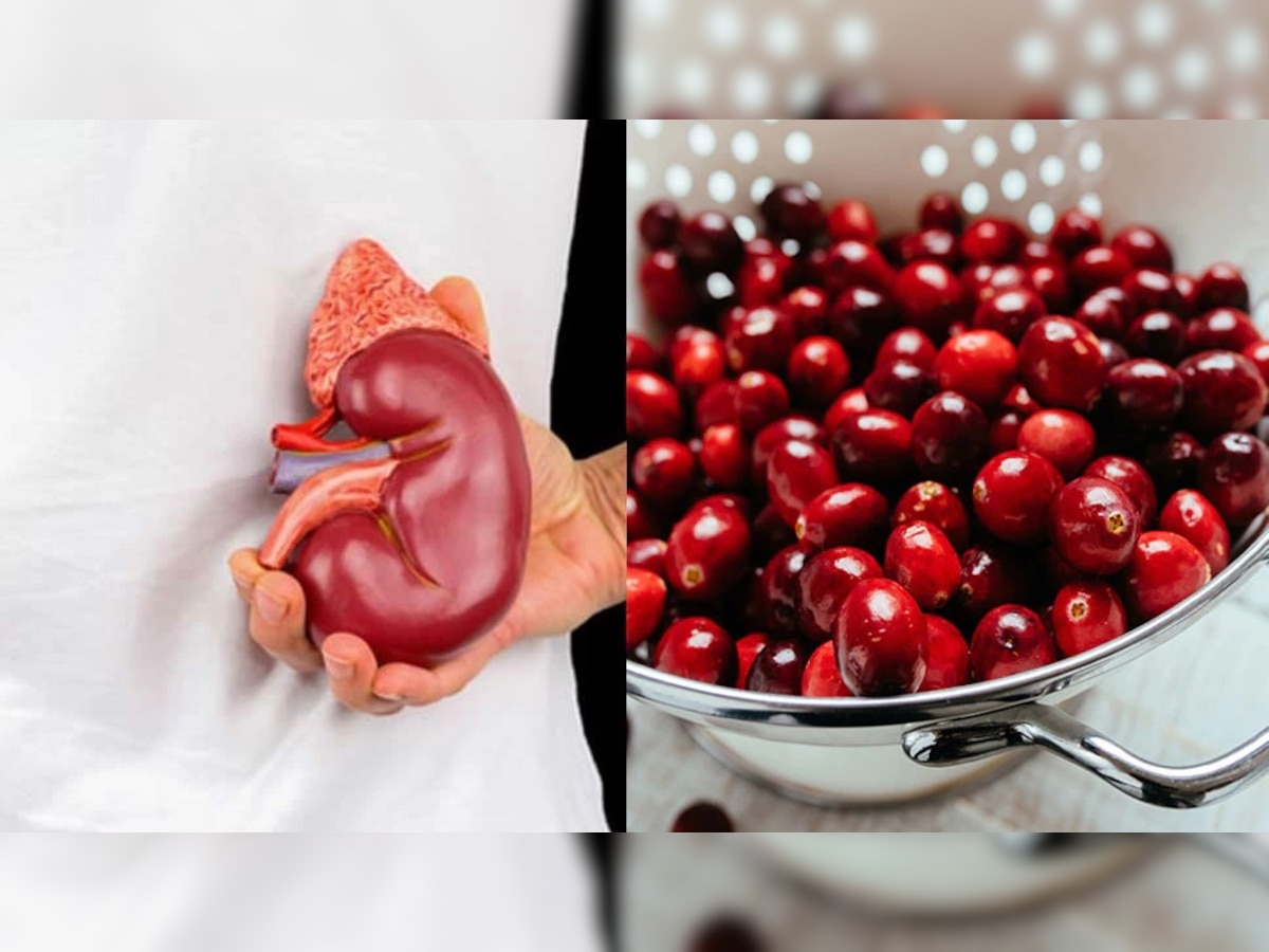 Food For Kidney: किडनी निकामी होण्यापासून टाळायचे असेल तर, या पदार्थांना द्या प्राधान्य title=