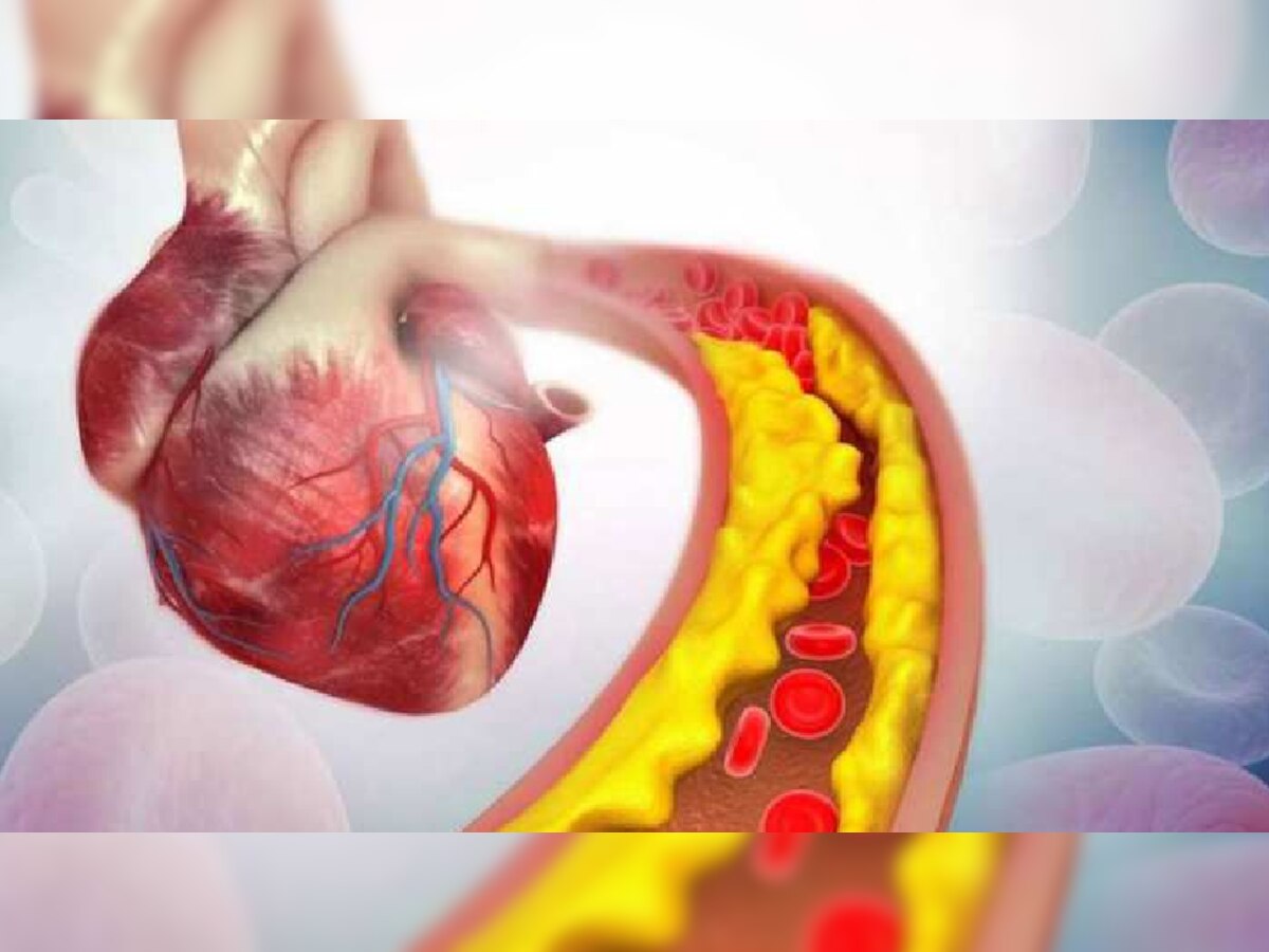 पायांमध्ये 'ही' लक्षणं दिसली तर सावधान; Cholesterol वाढल्याचे संकेत title=