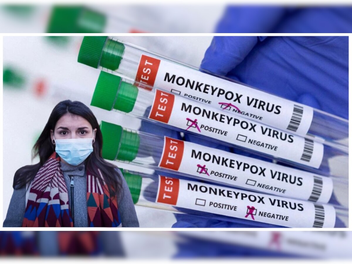 Monkeypox: मंकीपॉक्स व्हायरसचा पहिल्यांदाच माणसाकडून पाळीव प्राण्यांमध्ये फैलाव, जगातील पहिलीच केस समोर title=
