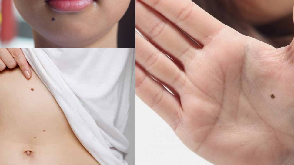 What does a mole on the left hand mean? - Quora