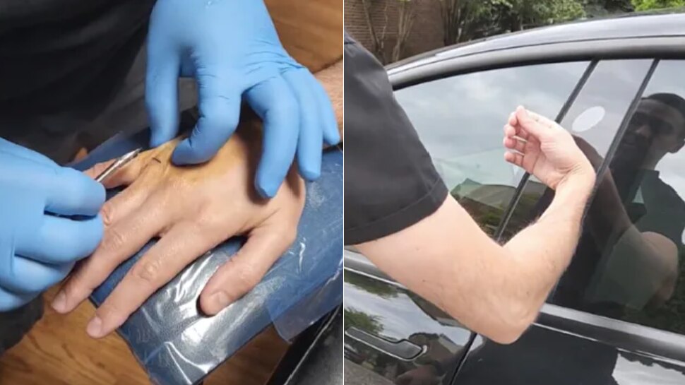 man implants chip in hands to open car doors and home doors with the