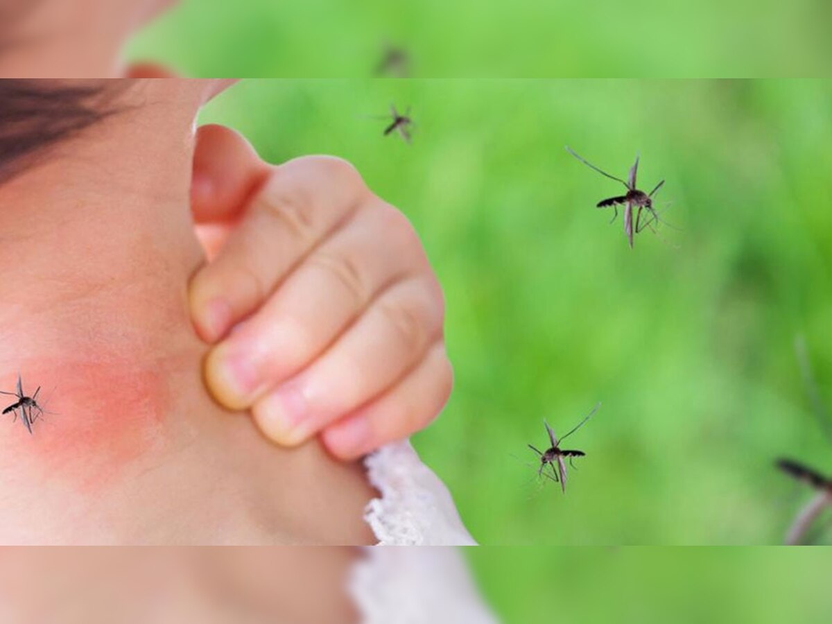 Mosquitoes Home Remedies: डासांच्या प्रादुर्भावामुळे हैराण, करा हे 4 घरगुती उपाय; तात्काळ आराम   title=