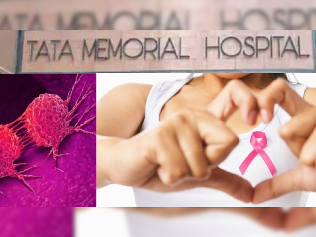 Tata Memorial Hospitals ला मोठे यश, ब्रेस्ट कॅन्सरवर महत्त्वपूर्ण संशोधन! एकदम कमी किमतीत उपचार title=