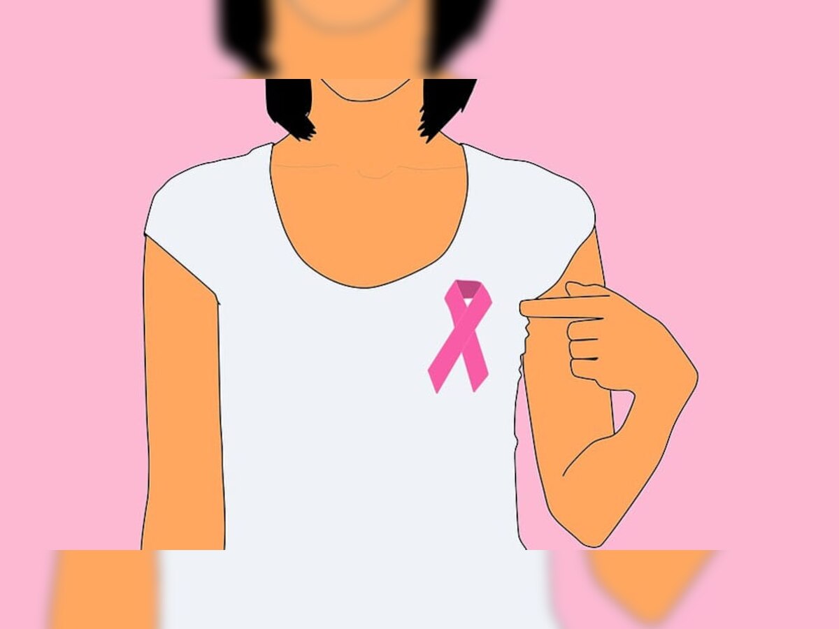 Breast cancer : अवघ्या 50 रूपयांत ब्रेस्ट कॅन्सरवर उपचार  title=