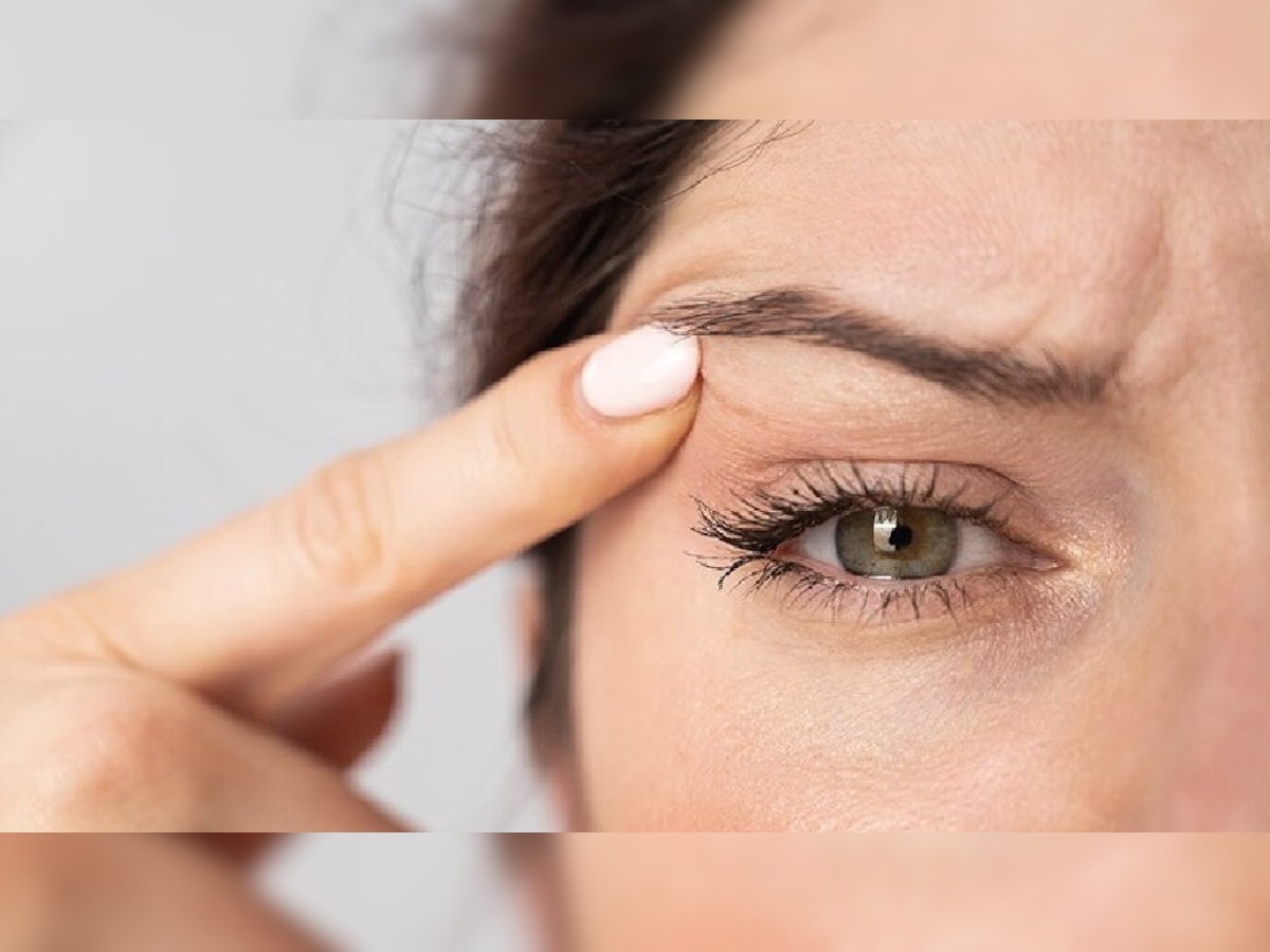 डोळा फडफडण्याची काय आहेत शास्त्रीय कारणं; एकदा जाणून घ्या title=