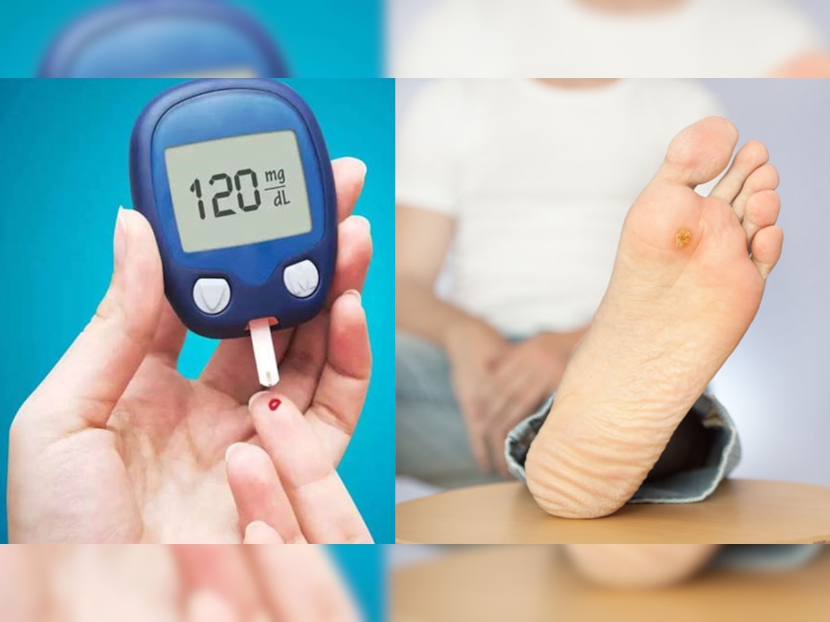 Diabetes होतो तेव्हा आपल्याला पाय देतात हे धोकादायक संकेत, तात्काळ करा Blood Sugar Test title=