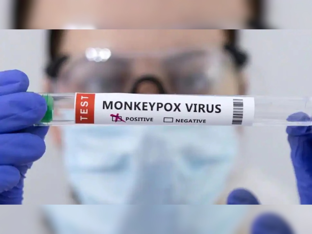 Monkeypox: देशात कोरोनानंतर वाढतोय मंकीपॉक्स; 'या' ठिकाणी रूग्णसंख्येत वाढ title=