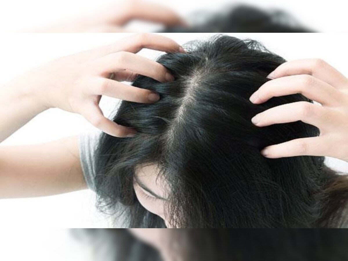 Hair Care Tips: डोक्याला खाज सुटल्याने त्रास होतो? हे करा घरगुती उपाय  title=