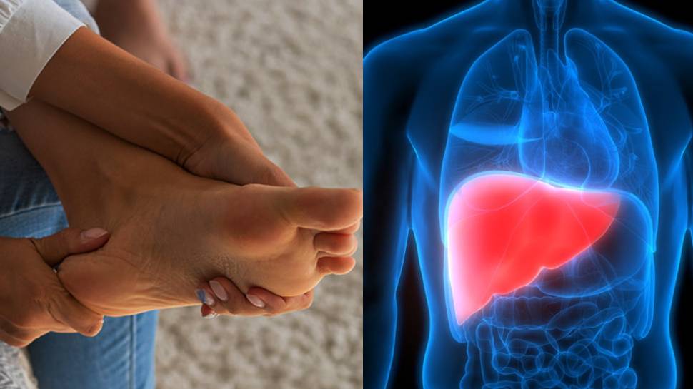 itching-palms-and-soles-is-symptom-of-damaged-liver-contact-doctor