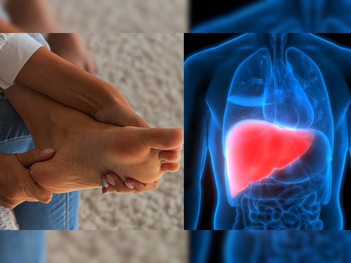 Liver Damage: तळहात आणि पायांना येतेय खाज, पैसे येणार नाहीत, लिव्हर आहे डॅमेज, डॉक्टरांना गाठा नाहीतर... title=