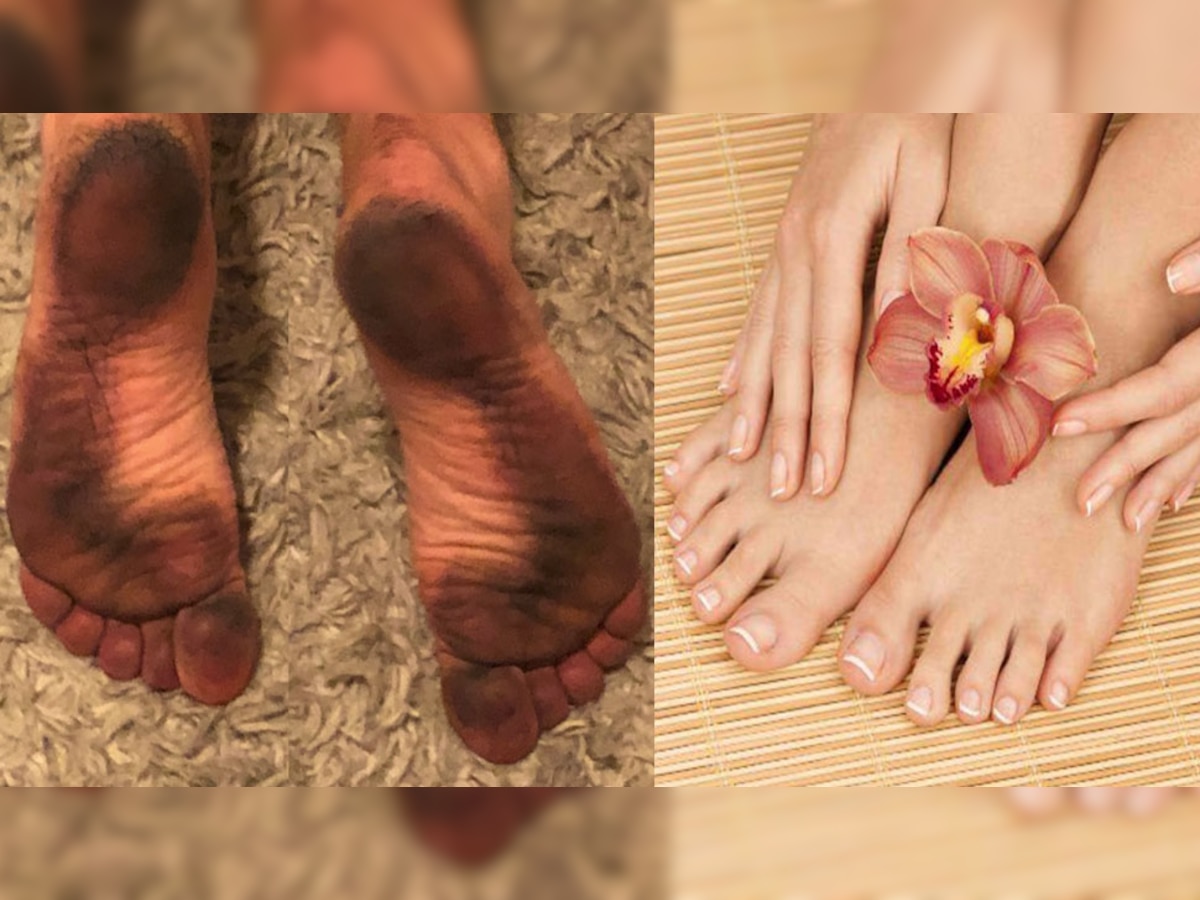 Feet Cleaning: वारंवार पाय जमिनीवर ठेवल्याने होतात घाण, अशा प्रकारे घालवा काळपटपणा title=