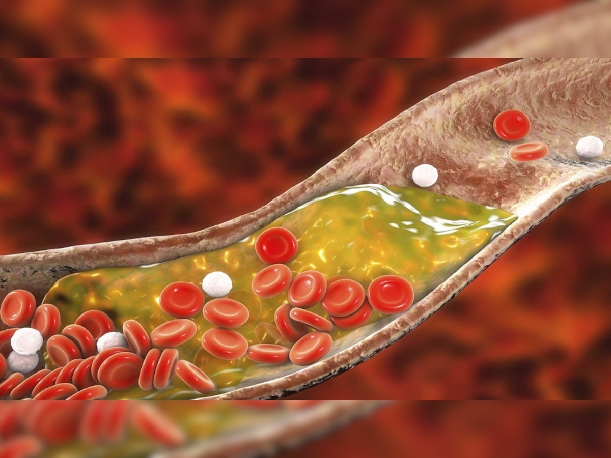 High Cholesterol वर या हिरव्या वनस्पतीच्या बिया ठेवतात नियंत्रण, डायबिटीजपासून मिळेल दिलासा title=