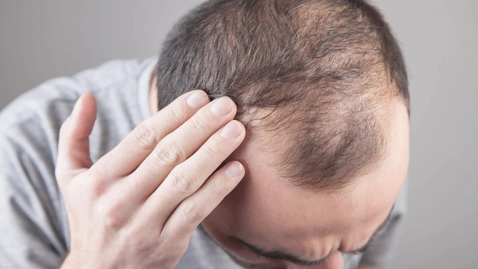 Health Marathi News Is applying oil to hair daily can cure baldness  problem  दररज कसन तल लवलयन टककल पडणयच समसय दर हऊ शकत  क जणन घय