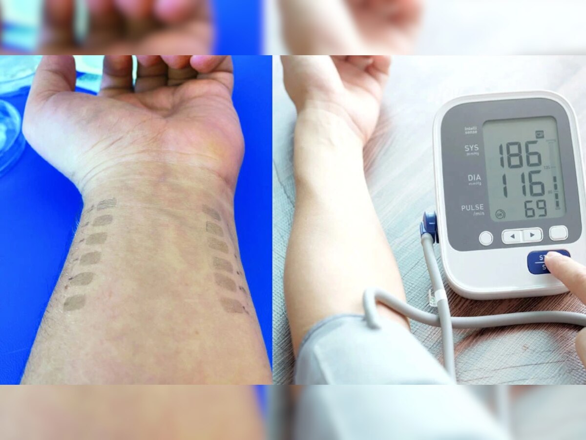 Blood Pressure : हा 'इलेक्ट्रॉनिक टॅटू' सांगेल तुमचा रक्तदाब, जाणून घ्या कसा काम करतो  title=