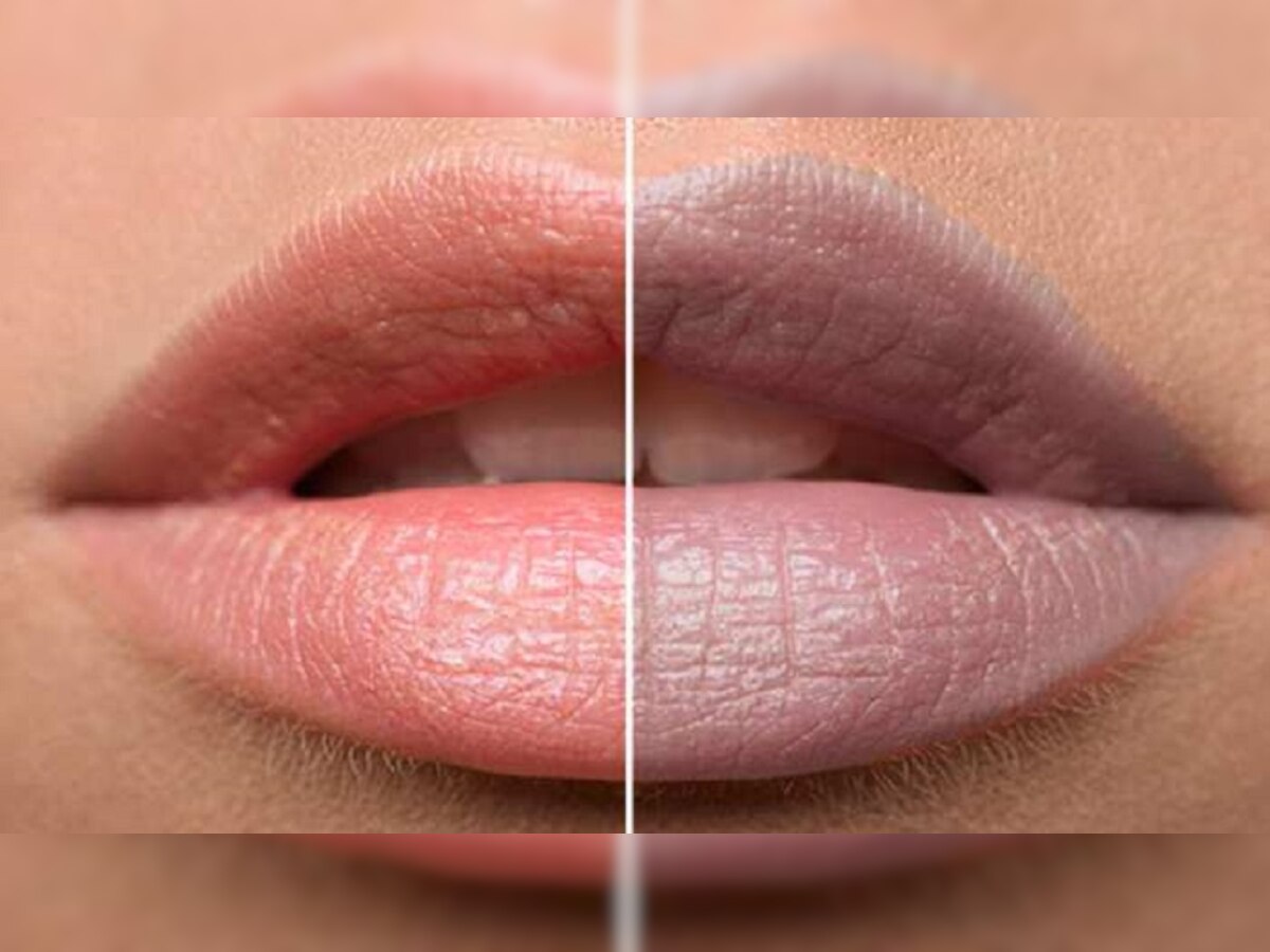 Dark Lips Remedy: ओठांचा काळेपणा दूर करायचाय, जाणून घ्या  title=