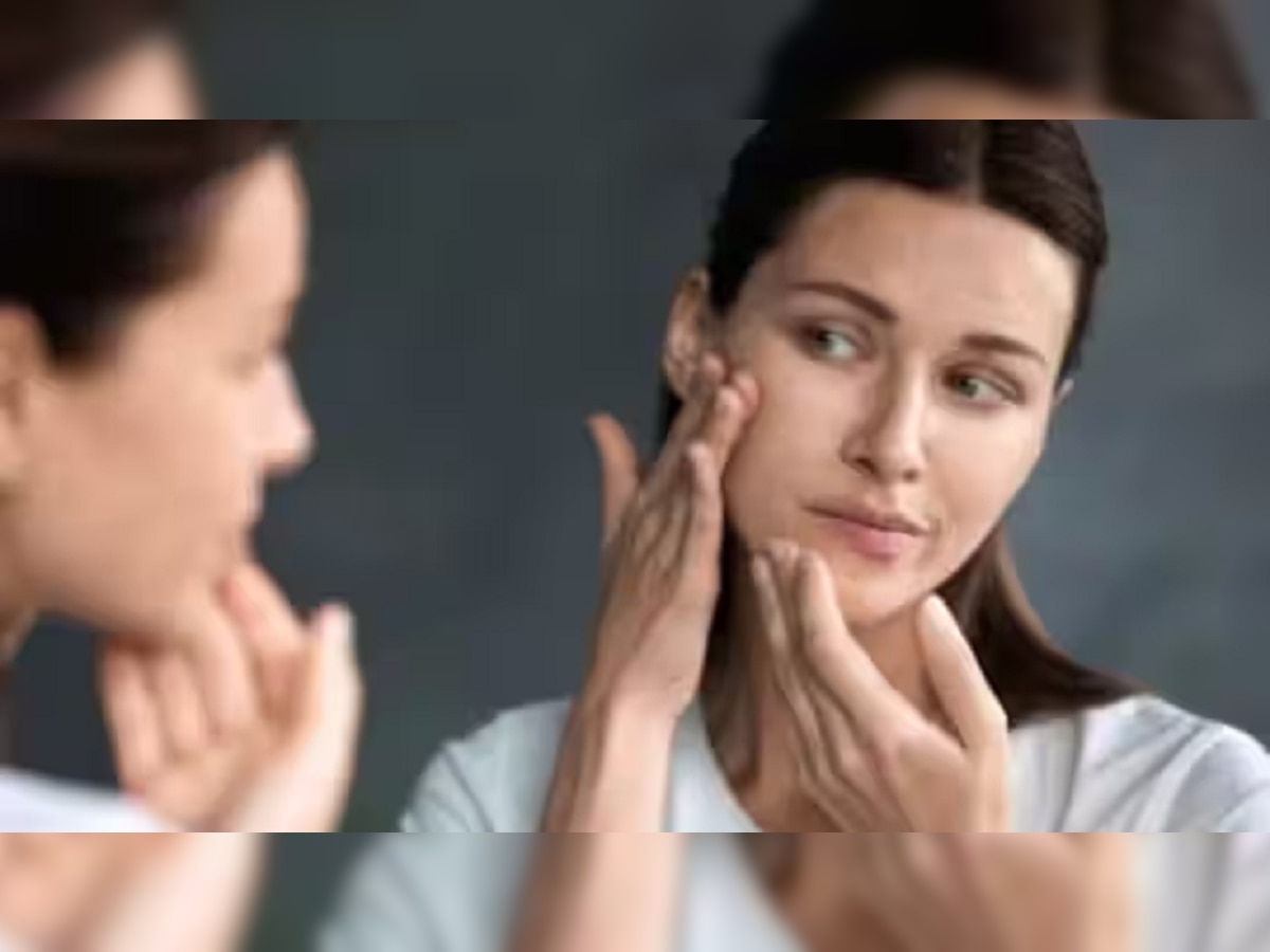 Skin Care Tips: तुमच्या चेहऱ्यावरील  व्रण घालवायचेत? फॉलो करा काही भन्नाट टिप्स title=