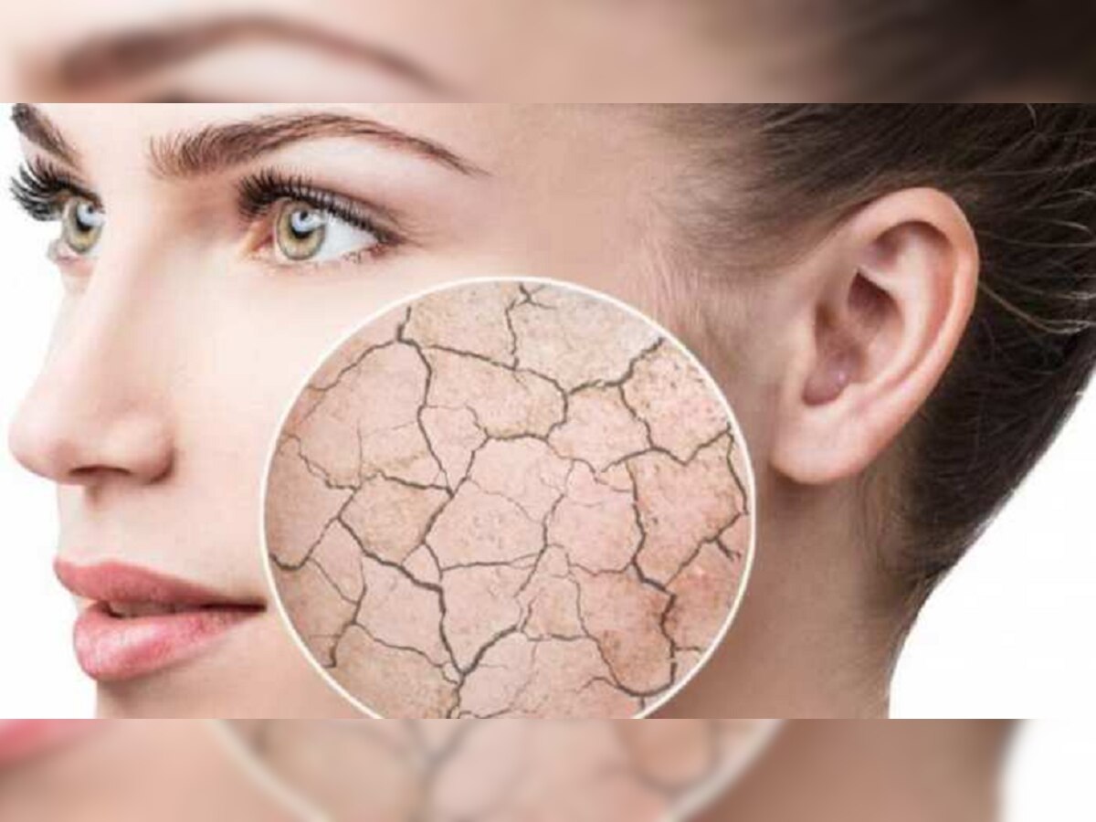 Skin Care : 'या' कारणांमुळे त्वचा होते Dry, जाणून घ्या  title=