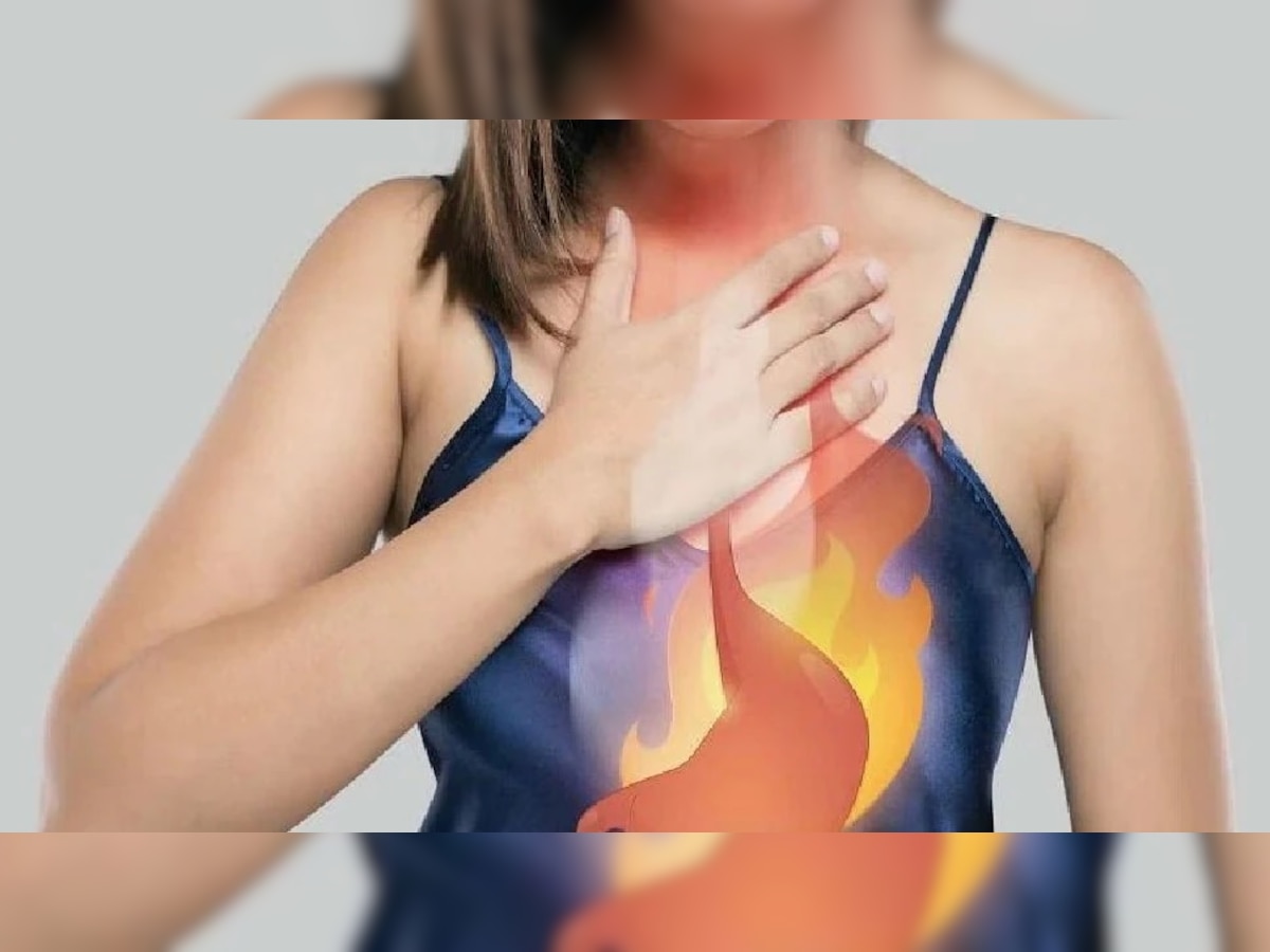 Acid Reflux: जेवल्यानंतर घशात होते जळजळ? कारण जाणून बसेल धक्का title=