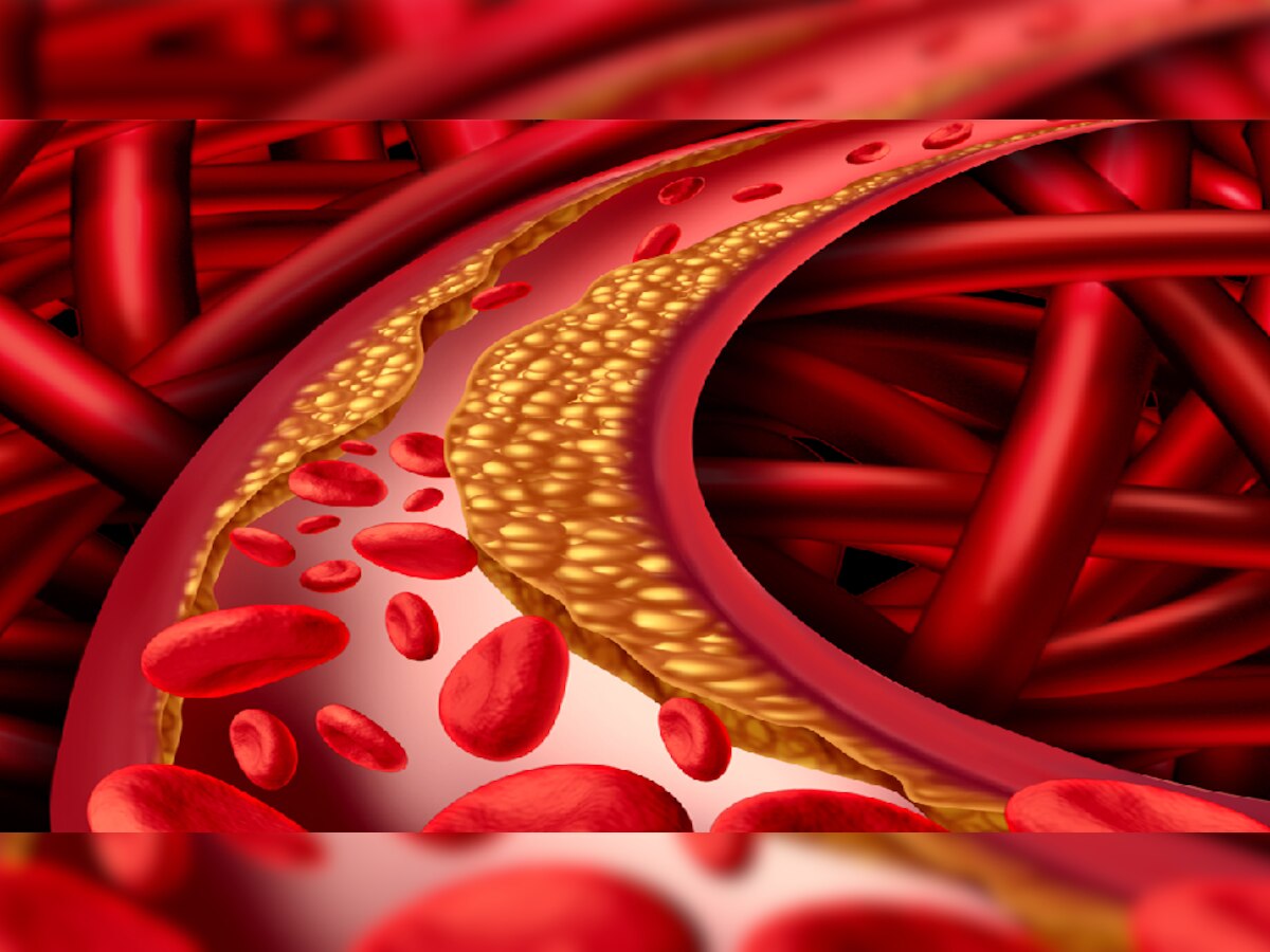 अयोग्य आहाराने वाढतंय रक्तातील High Cholesterol; केवळ 'हा' एक पदार्थ रोखू शकेल title=