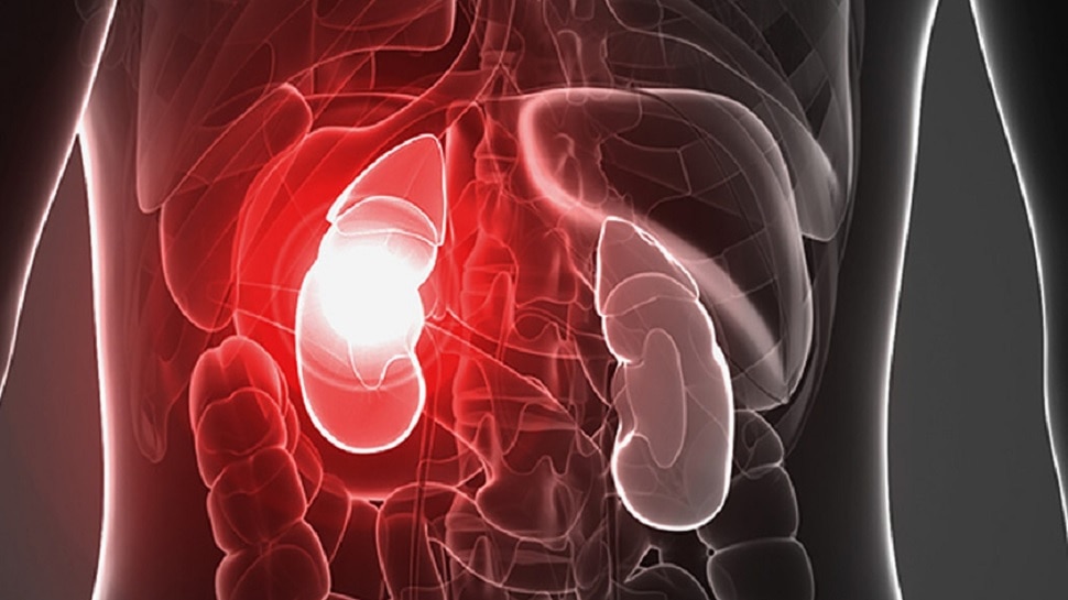 signs-of-kidney-problem-your-kidney-is-not-failing-sc