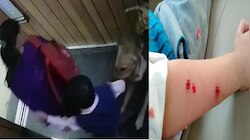 धक्कादायक! लिफ्टमध्ये येताच कुत्र्यानं केला लहानग्यावर हल्ला, Video Viral