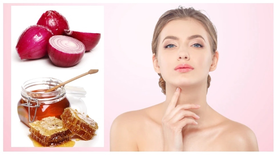 Beauty Remedies Onion And Honey Skin Benefits, Skin Care GS