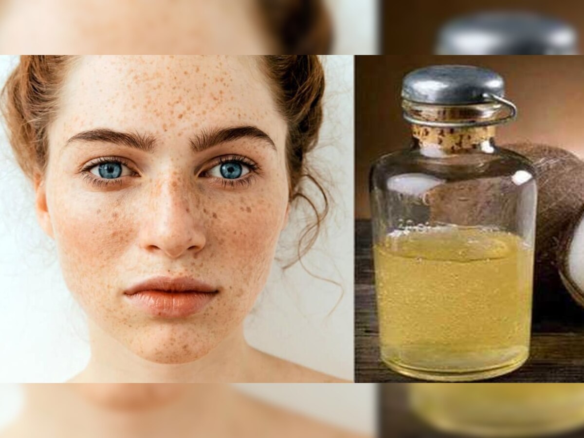 Skin Care: चेहऱ्यासाठी हे नैसर्गिक तेल खास अमृत, मुरुम आणि डाग होतील गायब title=