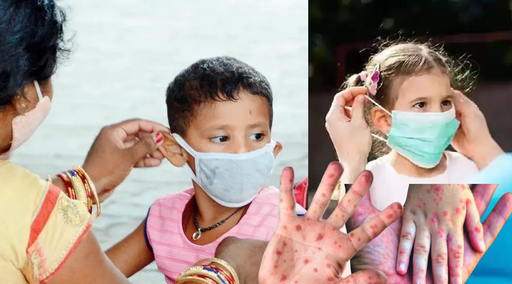 Measles Outbreak in Maharshtra Masks are mandatory for children GS