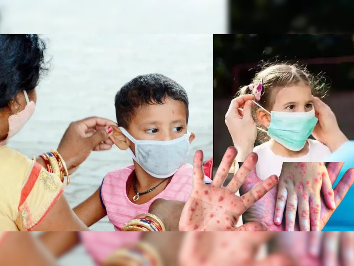 Measles Outbreak : गोवरचा धोका, 'या' ठिकाणी मुलांना मास्क बंधनकारक! title=