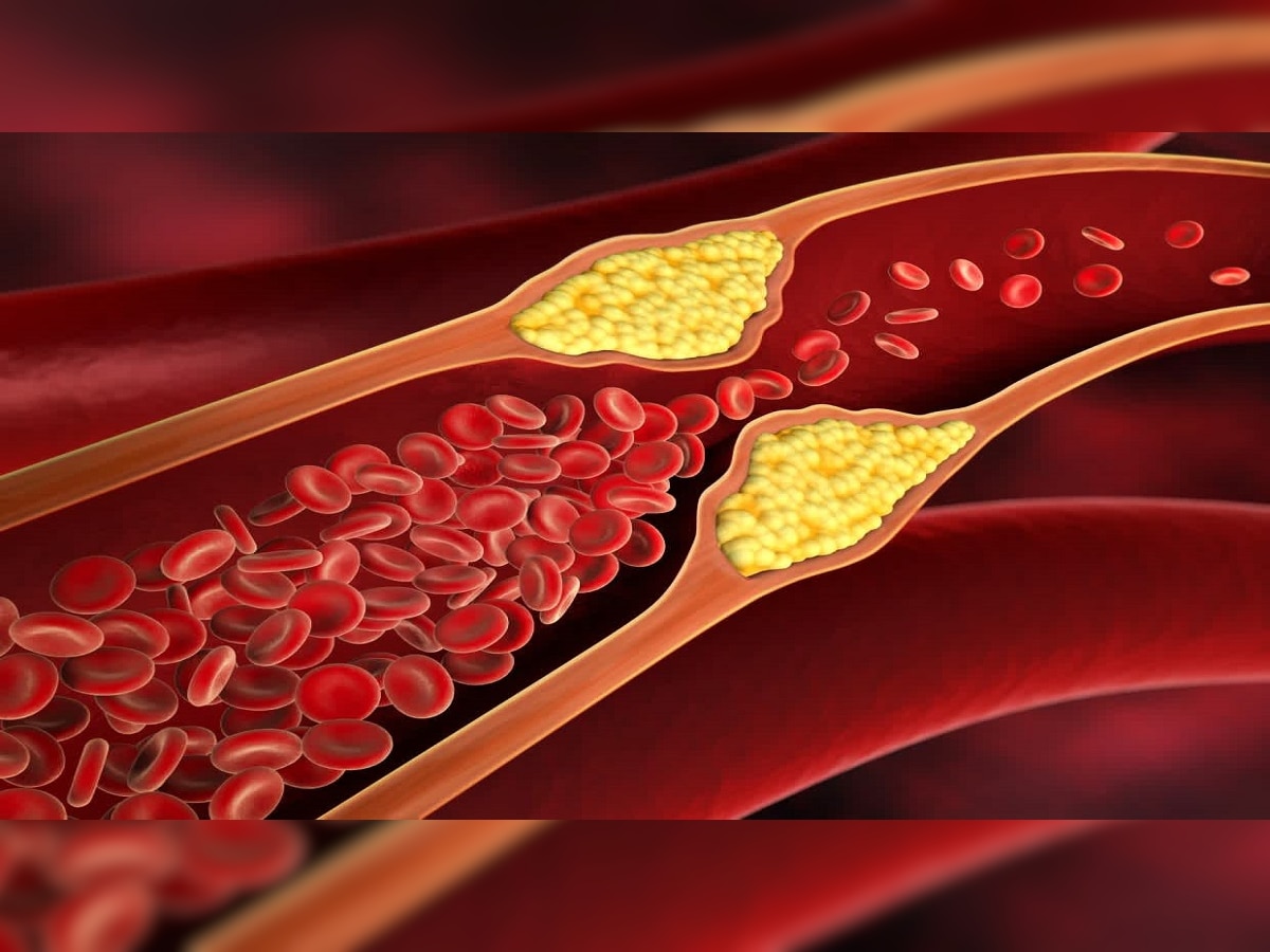  हिवाळ्यात 'हे' 5 पदार्थ खा, Bad Cholesterol होईल दूर  title=