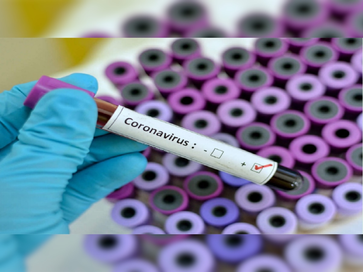 Coronavirus : "कोरोना अभी जिंदा है..."; आरोग्य मंत्रालयाची उच्चस्तरीय बैठक, गर्दीत मास्क घालण्याचा सल्ला title=