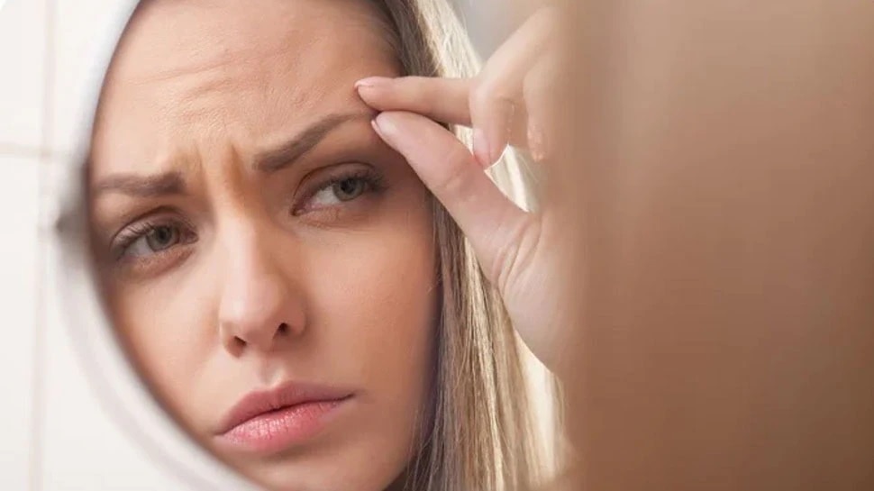 How To Get Rid Of Itchy Eyebrows